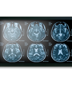 Onyx MEDDP-622HPN 21.5" Medical Touch Display