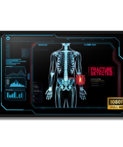 Onyx MEDDP-632F-P1 32" FHD Medical Touch Display